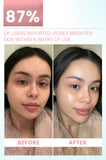 Brightening & Whitening Serum